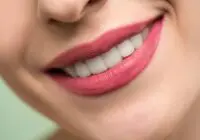 Vivid close-up image of a woman's smile showcasing red lipstick and white teeth on a light background.